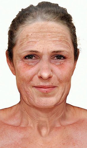 A harmadik képen jól látszik, milyen károkat okozhat a szolárium. Fotó: Daily Mail